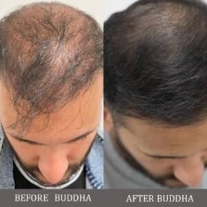 rosemary water for hair growth recipe